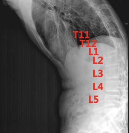 “我米乐 M6米乐想平视家人的眼睛说话”(图2)