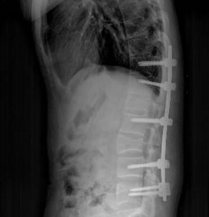 “我米乐 M6米乐想平视家人的眼睛说话”(图3)