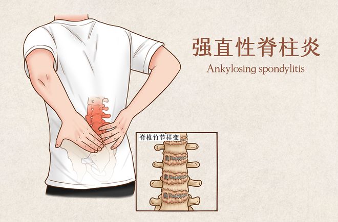 “我米乐 M6米乐想平视家人的眼睛说话”(图4)
