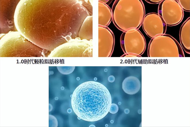 纳米脂肪的神奇用途你知道吗?(图4) 纳米脂肪的神奇用途你知道吗?(图4)