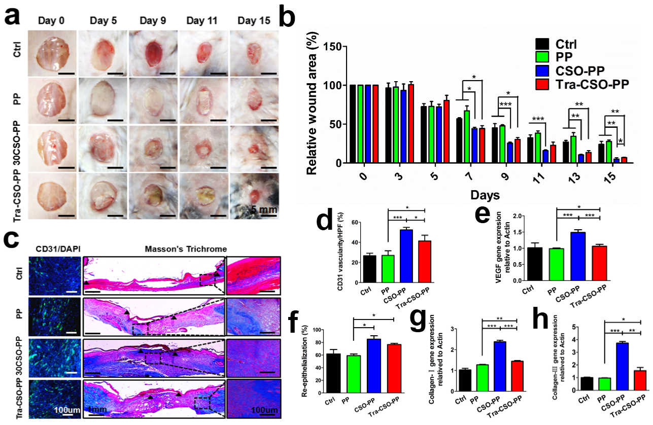 上海硅酸盐所在黑色素瘤治疗与创伤修复用智能生物支架材料方面取得重要进展(图3) 上海硅酸盐所在黑色素瘤治疗与创伤修复用智能生物支架材料方面取得重要进展(图3)
