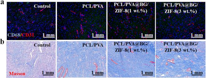 南工大陈苏教授福建农林大庞杰教授ACS AMI:静电纺丝技术制备高性能人造皮肤(图5) 南工大陈苏教授福建农林大庞杰教授ACS AMI:静电纺丝技术制备高性能人造皮肤(图5)